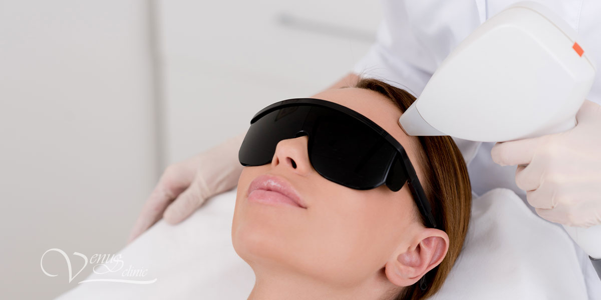 Laser facial hair removal - Venus Clinic EN