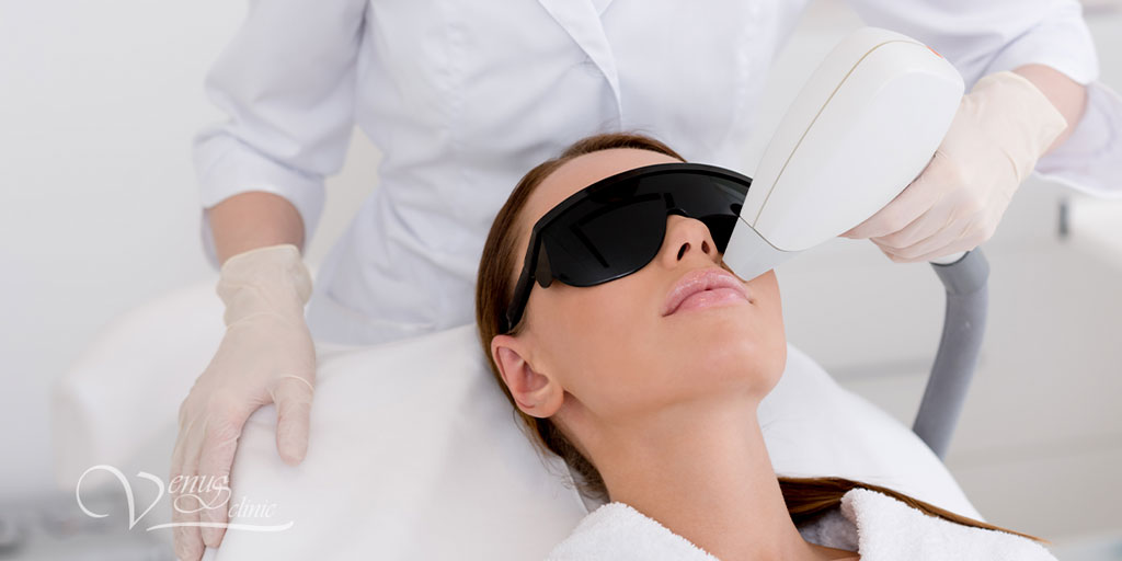 Laser facial hair removal - Venus Clinic EN