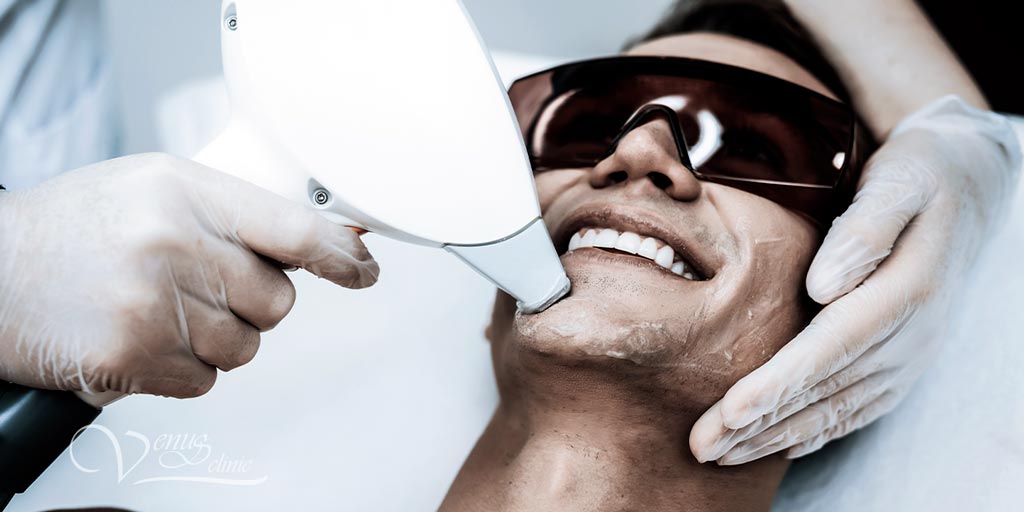laser hair removal for men face