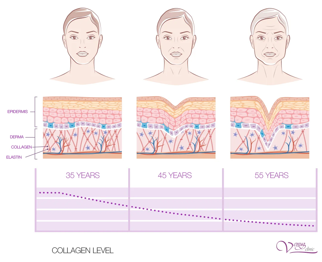 Skin layer diagram demonstrates decrease in collagen, elastin, hyaluronic acid with age.