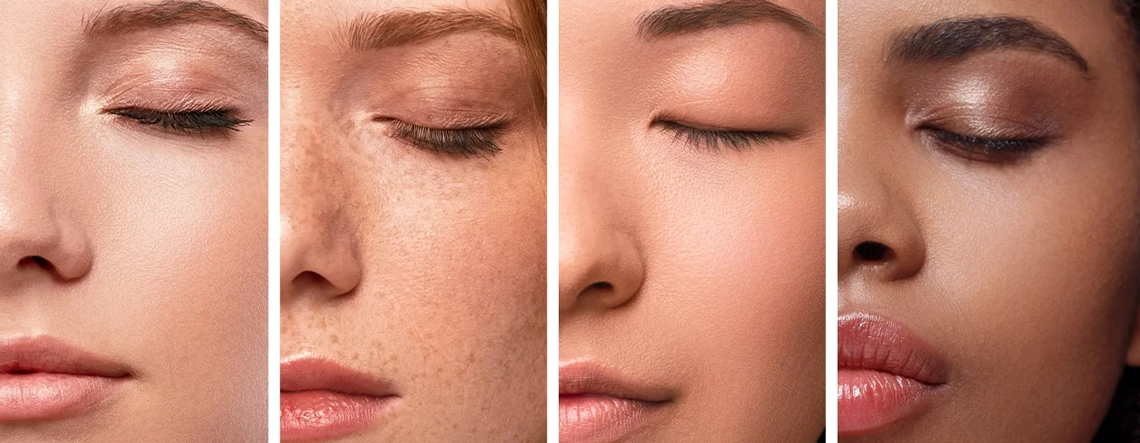 Melanin and its effect on skin color