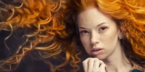 Freckles, age spots, red hair