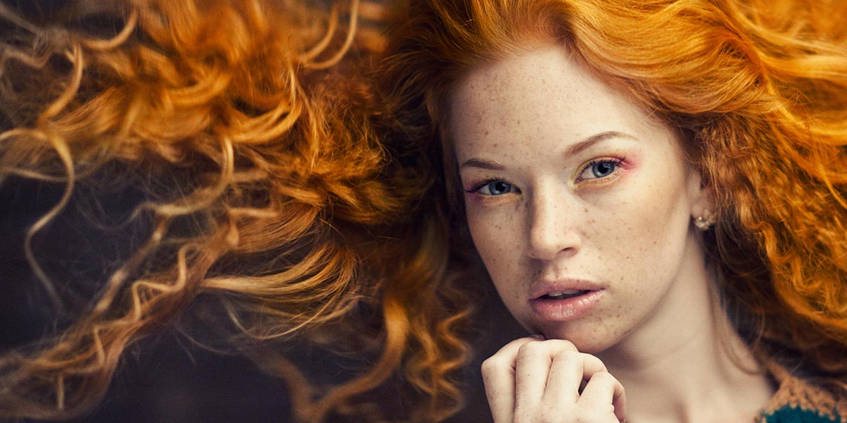 Freckles, age spots, red hair