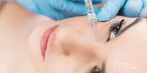 Tear Trough Filler Treatment