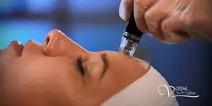 Vacuum face cleaning