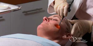 SensiPeel пілінг для чутливої шкіри