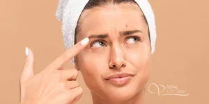 Пилинг при акне