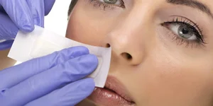 Гирсутизм, волосы на лице у девушки