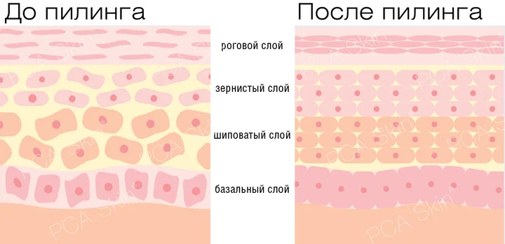 Пилинг SensiPeel PCA Skin анатомия кожи