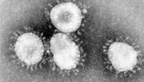 електронна мікроскопія коронавірусу