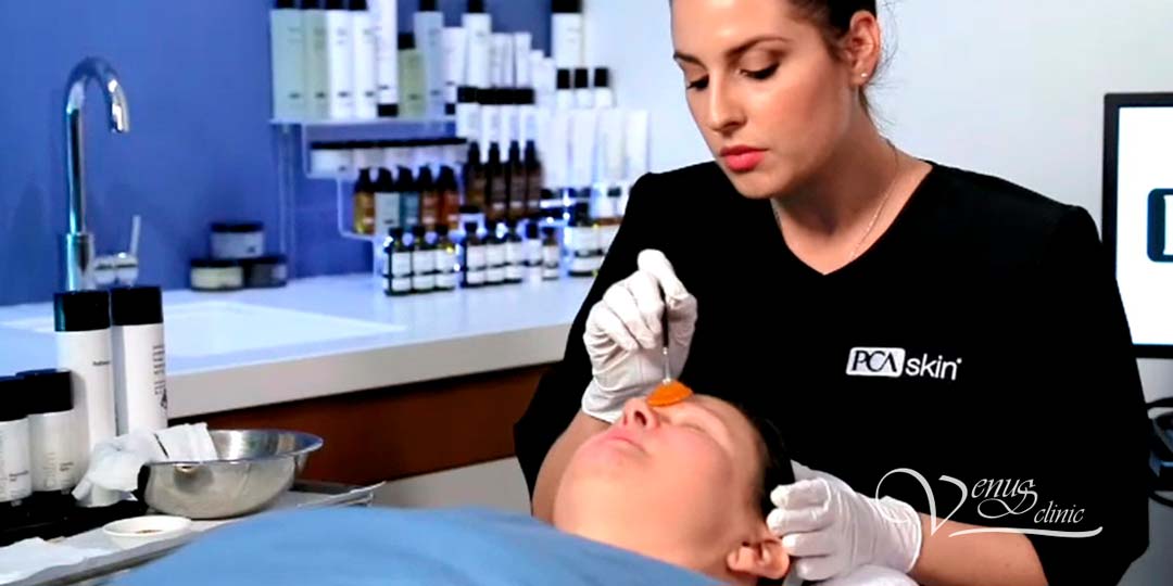пацієнт, косметологі виконує хімічний пілінг обличчя